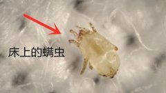 床上被子上的螨虫图片 在显微镜下真实的螨虫是什么样子的图片